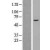 Western Blot: ABCB8 Lysate [NBL1-07177] - Western Blot experiments. 
Left-Control; Right -Over-expression Lysate for ABCB8